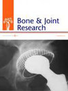 Bone & Joint Research杂志封面
